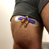 Wira-Flexi: Secure & Comfortable Catheter & Tube Fixation Device