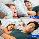 Anti Snoring Nasal Dilators & Mouth Guard